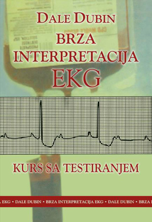 ekg